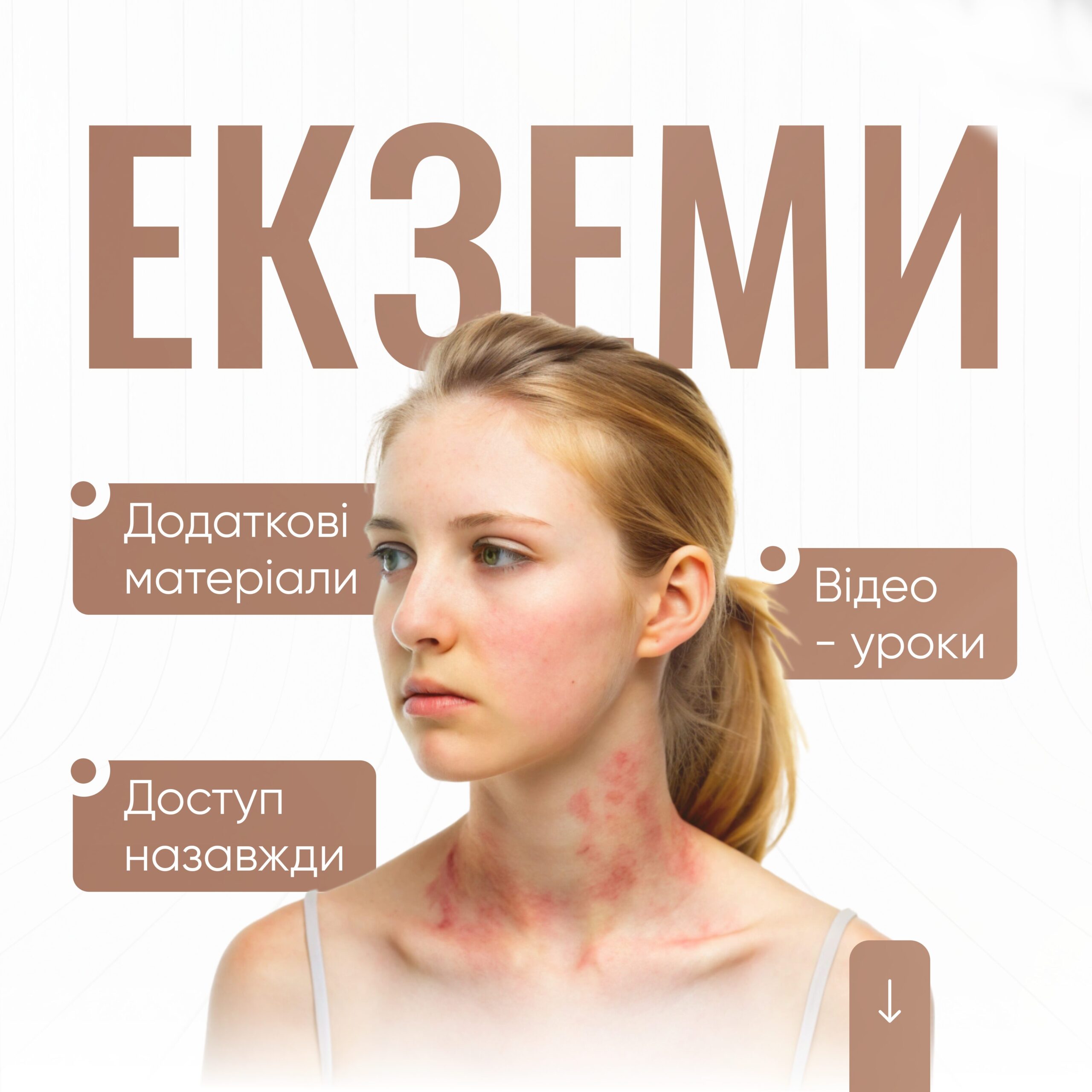 Екземи