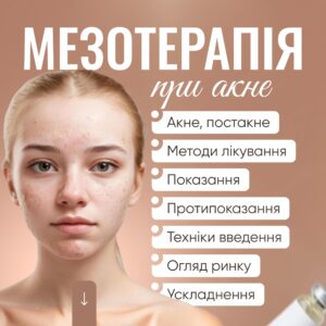 Мезотерапія при акне
