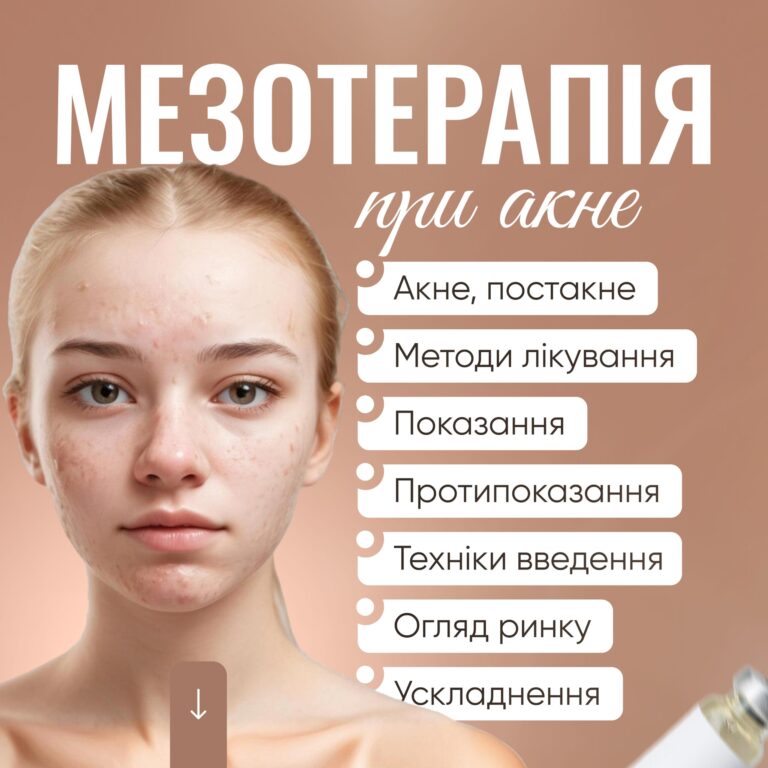 Мезотерапія при акне