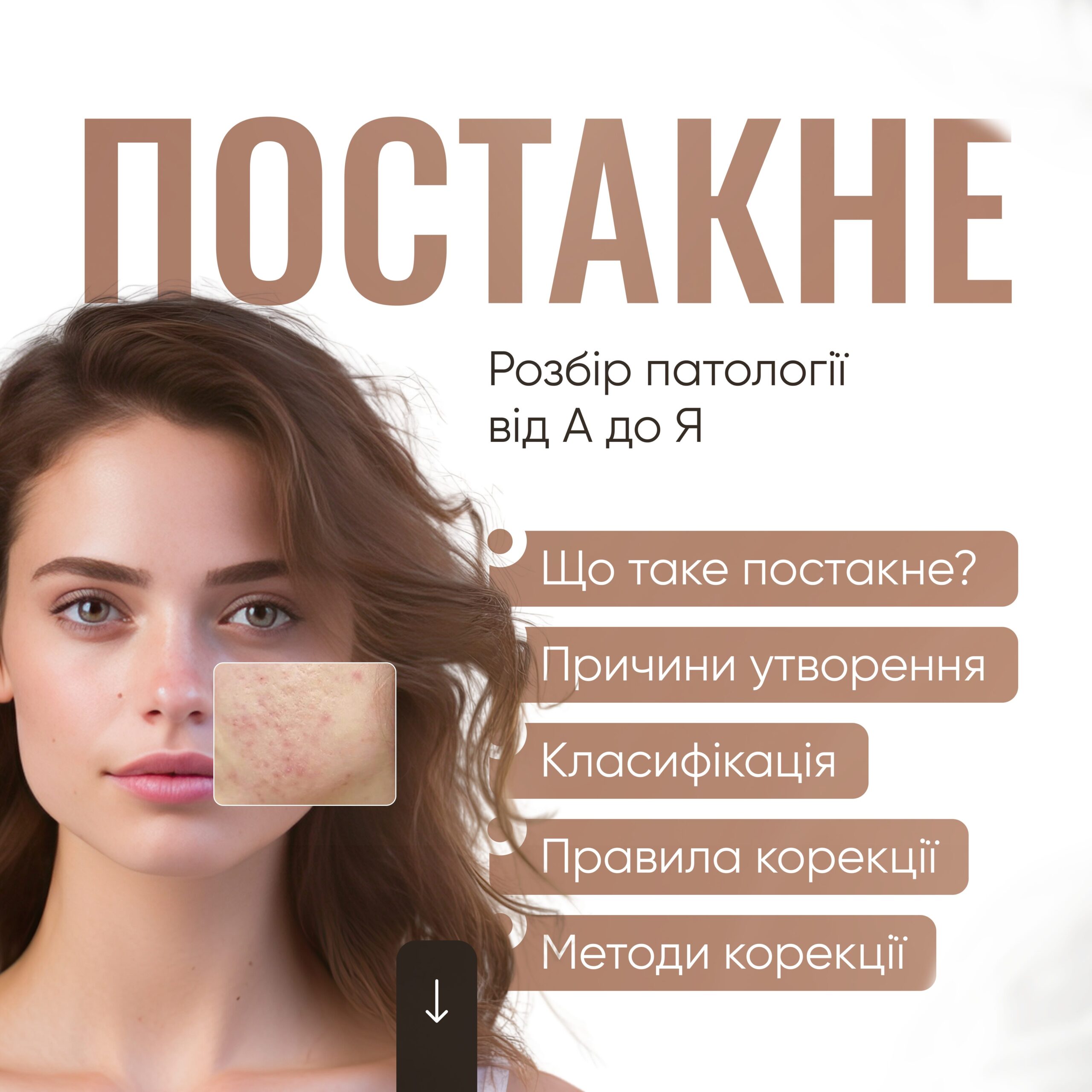 Постакне. Розбір патології від А до Я