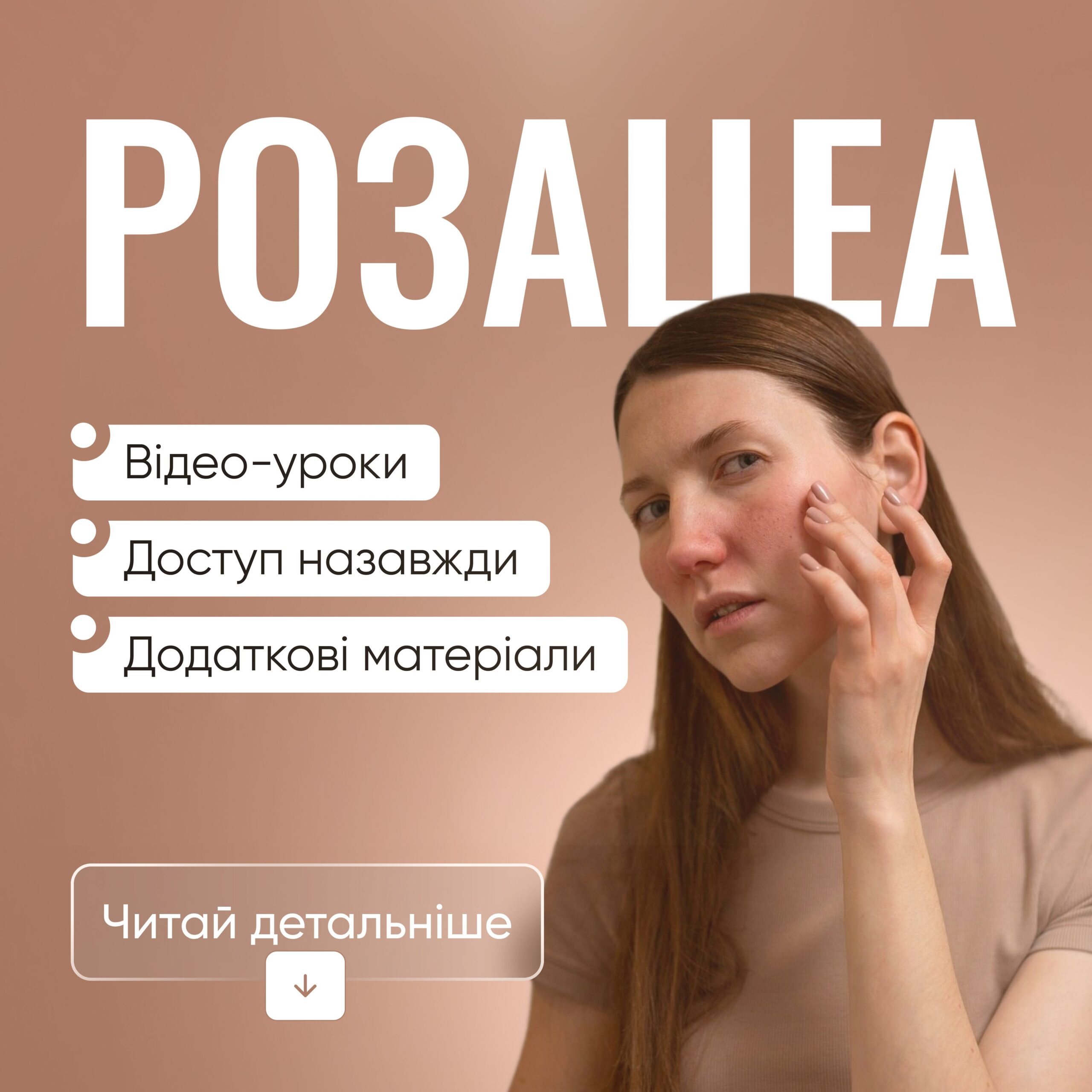 Розацеа