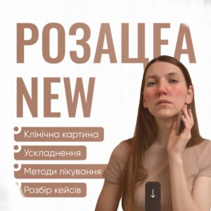 Розацеа NEW