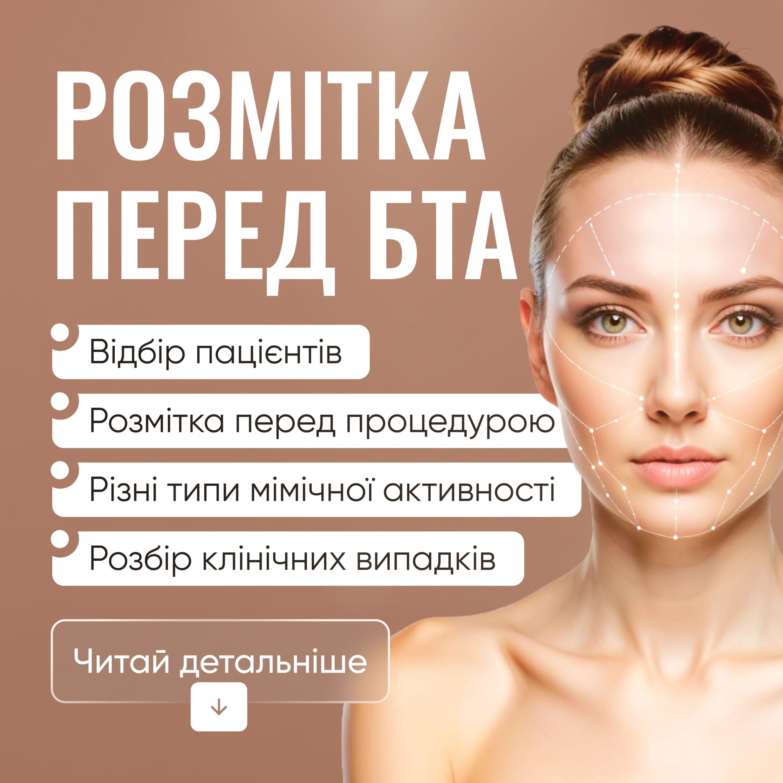 Розмітка перед ботулінотерапією