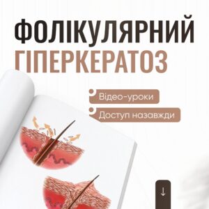 Фолікулярний гіперкератоз