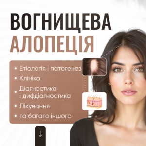Вогнищева алопеція