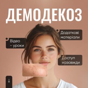 Демодекоз