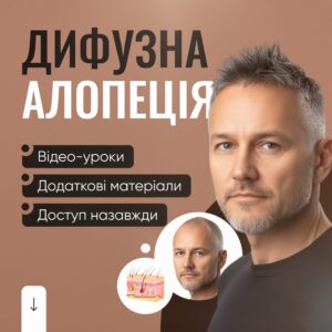 Дифузна алопеція