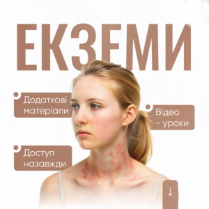 Екземи