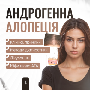 Андрогенна алопеція