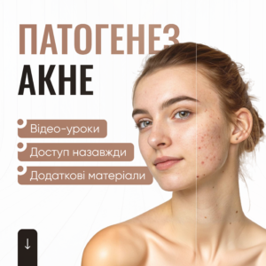 Патогенез акне