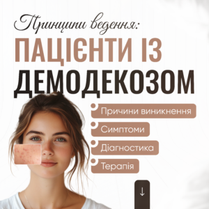 Принципи ведення пацієнтів із демодекозом