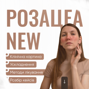 Розацеа NEW