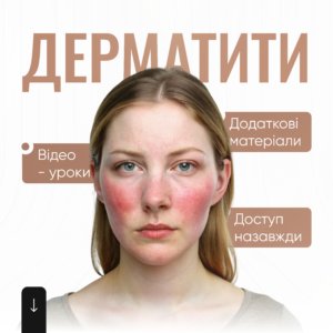 Дерматити