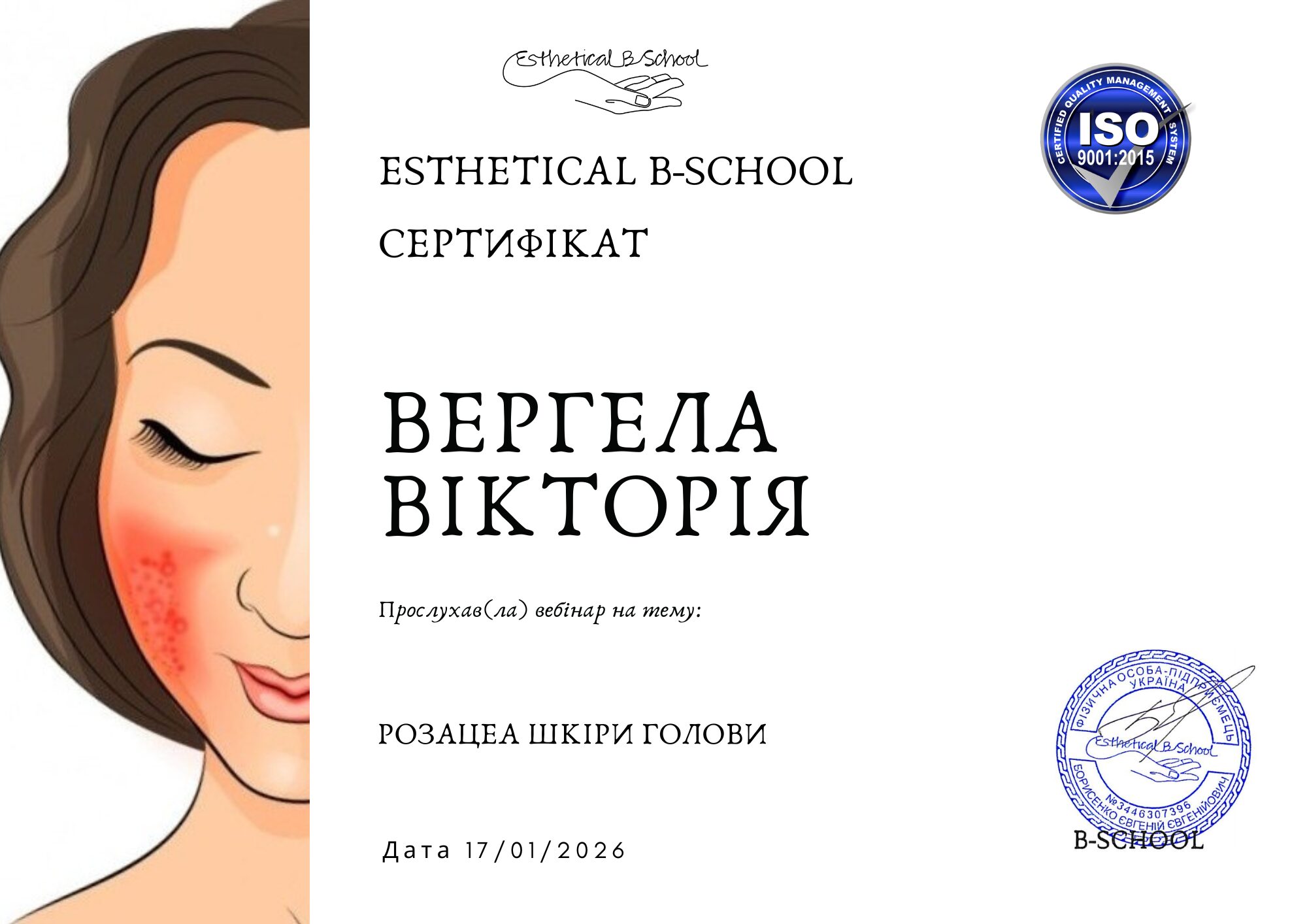 Розацеа шкіри голови - Зображення 3
