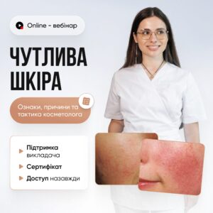 Синдром чутливої шкіри