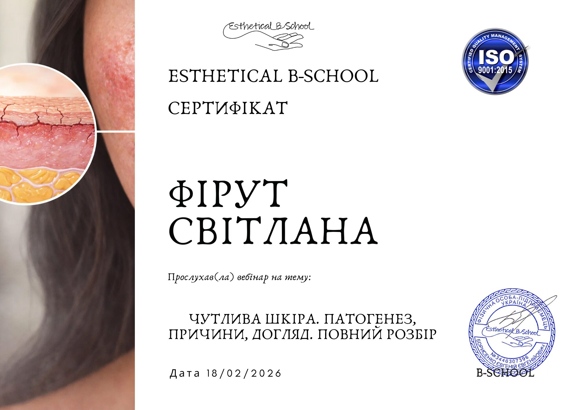 Синдром чутливої шкіри — вебінар для косметологів - Зображення 3